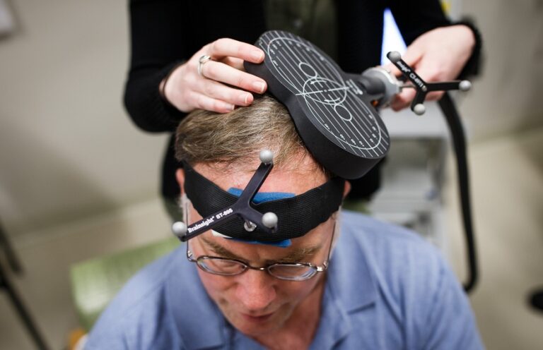 Transcranial Magnetic Stimulation