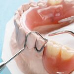 gold coast denture repair