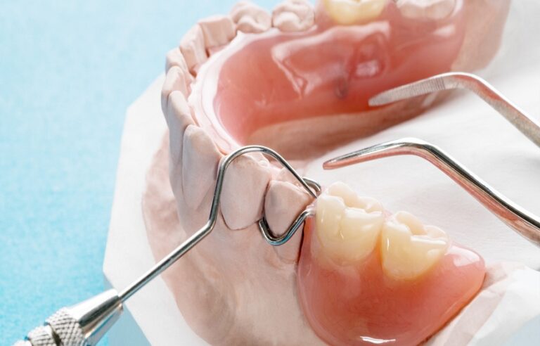 gold coast denture repair