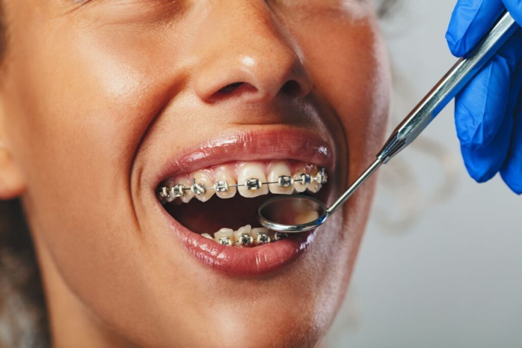 Oral Care a Natural Part of Orthodontic Treatment