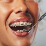 Oral Care a Natural Part of Orthodontic Treatment